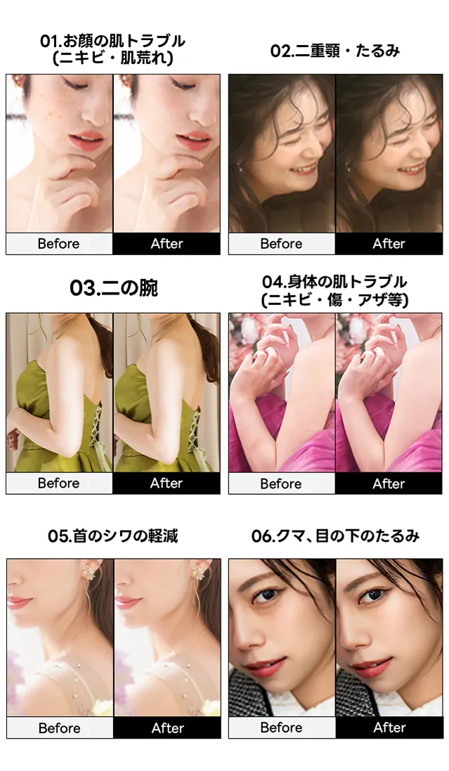 気になる代表の３ヶ所のレタッチで、お悩みやコンプレックスをしっかり解決！自然に補正いたします。
